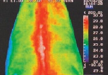 Circulation sanguine et Equissage Pulse